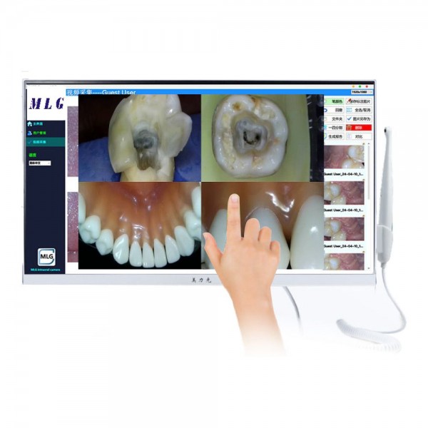 Интраорална камера с 23,8" All-in-One сензорен компютър M-568